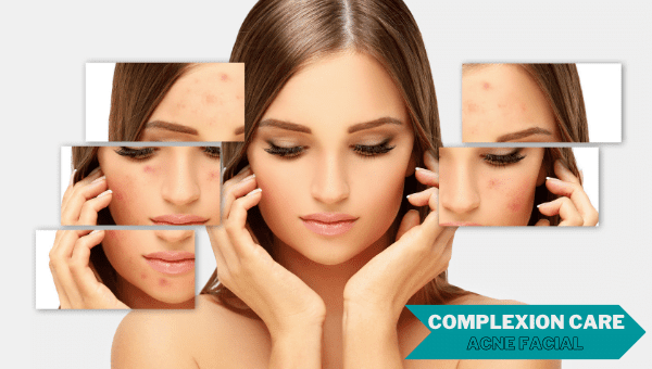 Clear Complexion Care / Acne Facial