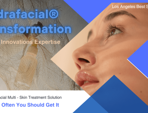 Hydrafacial: Everything You Need to Know and How Often You Should Get It