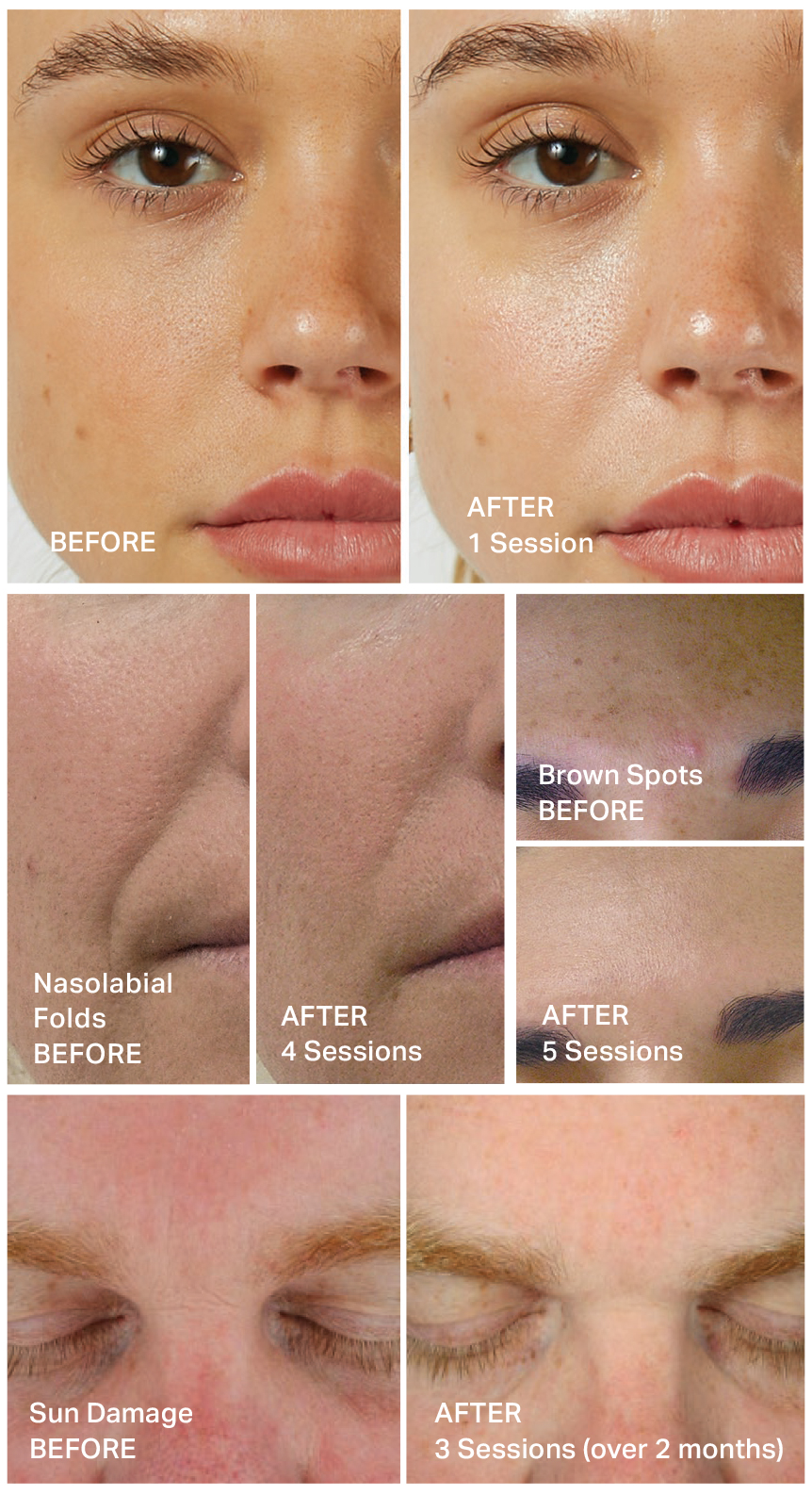 hydrafacial-brochure-2