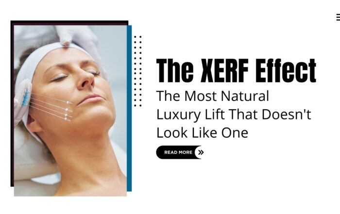The XERF Effect