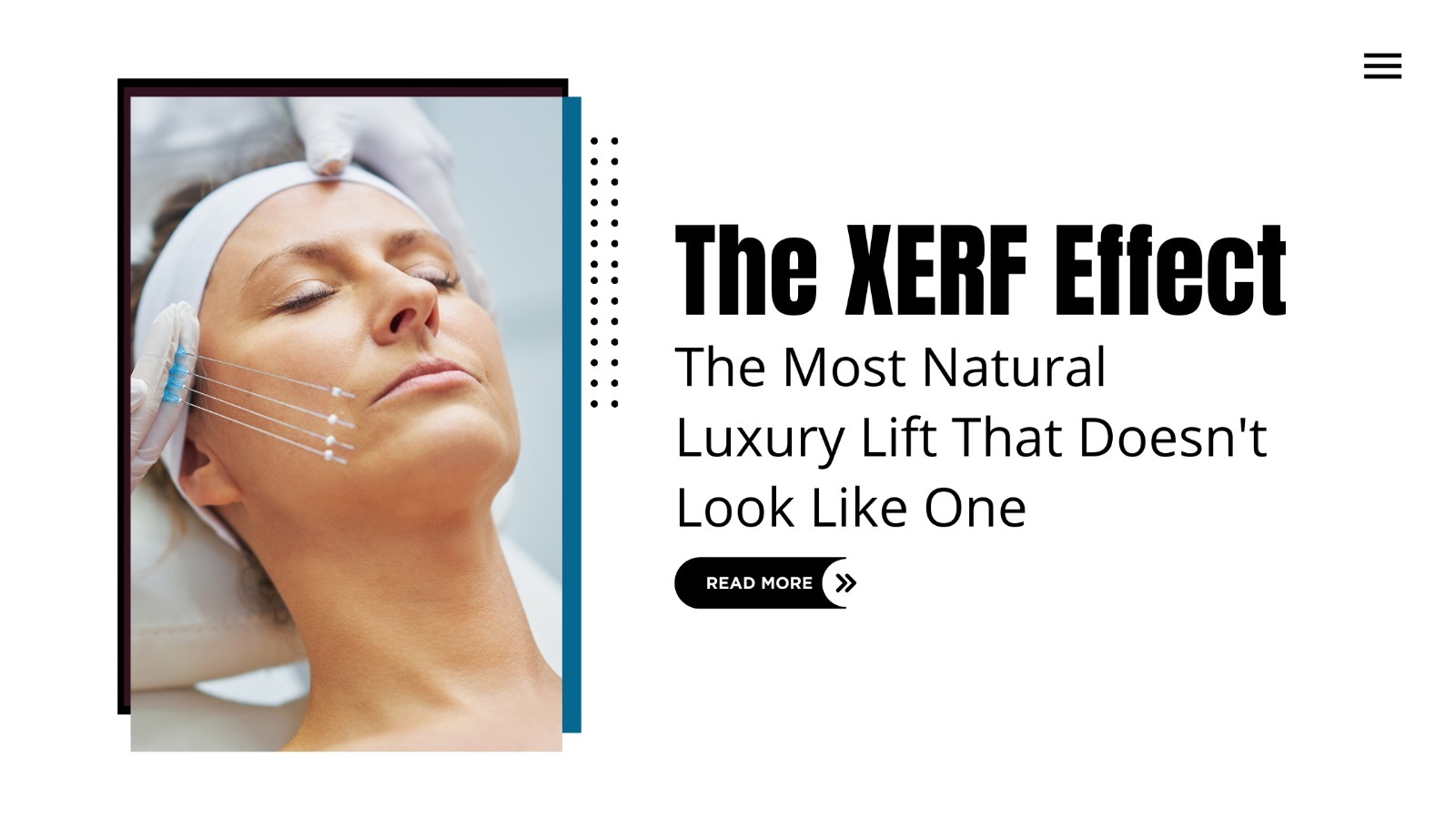The XERF Effect