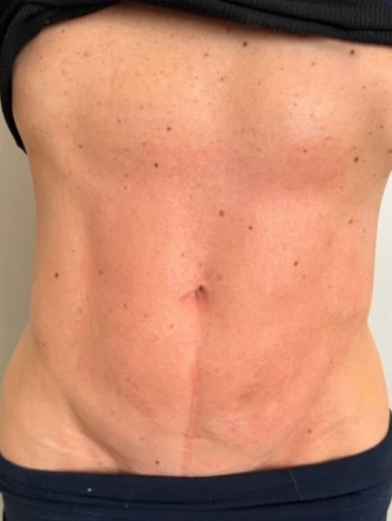 stomach-after-crop