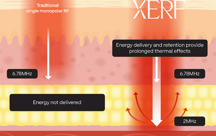 xerf-infographic